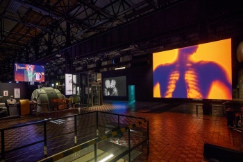 preview X Ray 11.1 9b 30cm Breite