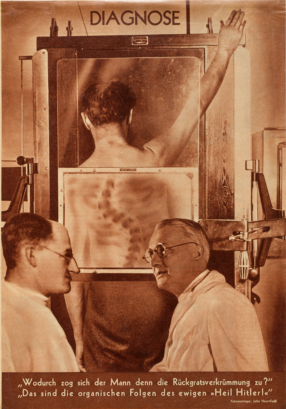 KS Heartfield Rueckgrat1